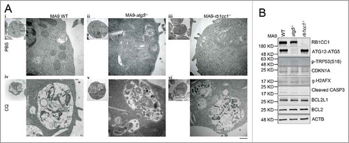 Figure 5. Atg5 or Rb1cc1 deficiency does not affect the lysosomal degradation pathway. (A) MA9 wild-type, MA9-atg5−/− and MA9-rb1cc1−/− leukemia cells were treated with chloroquine at 25 μM for 6 h followed by TEM imaging. Scale bar: 500 nm. (B) MA9 wild-type, MA9-atg5−/− and MA9-rb1cc1−/− leukemia cells cultured under basal condition were harvested and used for western blot analysis (n = 2 repeats).