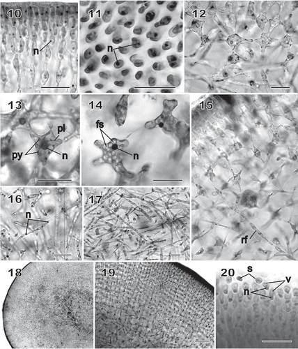 Figs 10–20 Chondrymenia lobata. Vegetative and spermatangial morphology (Figs 10, 12, 13, 16, 17: HGI-A 6905; Figs 11, 14, 18, 19: HGI-A 2617; Fig. 15: HGI-A 8384; Fig. 20: HGI-A 3267). Figs 10, 11, 14–16, 20, haematoxylin stained; Figs 12, 13, 17–19, aniline-blue stained. 10. Transverse section of outer cortical layer showing uninucleate (n) cells. 11. Uninucleate (n) outer cortical cells in surface view. 12. Transverse section at boundary between subcortical and outer medullary layers. 13. Subcortical cell with a nucleus (n) and a reticulate plastid (pl) and containing pyrenoid-like structures (py). 14. A uninucleate (n) subcortical cell densely filled with floridean starch grains (fs). 15. Rhizoidal filament (rf) growing towards the medulla through a latticework of subcortical cells. 16. Single nuclei (n) in cells of medullary filaments. 17. A dense weft of rhizoidal filaments intermixed with primary medullary filaments. 18. Transverse section of a stipe. 19. Enlarged view of stipe cortex showing cellular arrangement. 20. Spermatangia differentiating into and releasing uninucleate (n), vacuolate (v) spermatia (s) from surface of spermatangial sorus. Scale bars = 20 µm (Figs 10–17, 20), 200 µm (Fig. 18) and 50 µm (Fig. 19).