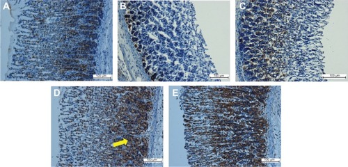 Figure 7 Immunohistochemical analysis of Hsp70 expression from five groups of rats, namely: (A) normal control, (B) lesion control, (C) low dose of EEAM, (D) high dose of EEAM, and (E) omeprazole control. Immunohistochemistry staining showed upregulation of Hsp70 in groups C–E. (A) and (B) are presenting the normal control and lesion control groups, respectively. The yellow arrow shows Hsp70 accumulation in gastric tissue (20×).