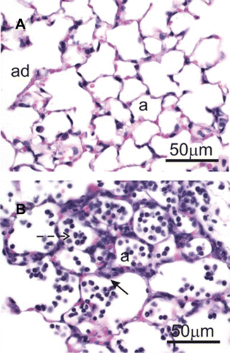 Figure 4.  Effect of CBD on type II epithelial cell proliferation. Mice were treated as outlined in the legend for Figure 2. Left lung lobes (24 h post-LPS) were fixed and sections were stained with hematoxylin and eosin. (a) Sal/CBD; (b) LPS/CBD. Dashed arrow depicts neutrophils; arrow depicts type II epithelial cell proliferation. a, alveoli; ad, alveolar duct.