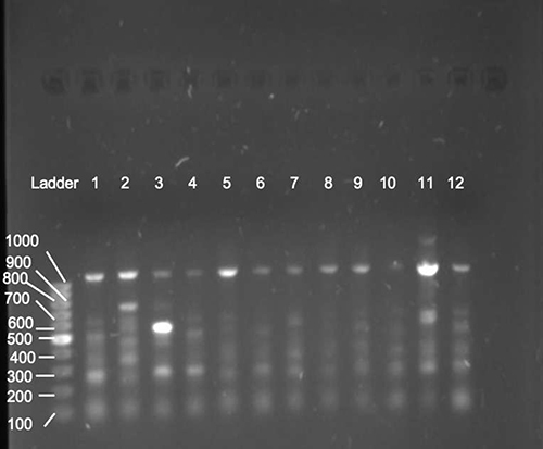 Figure 3 ERIC-PCR generated DNA fingerprints of Elizabethkingia isolates.