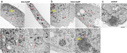 Figure 1. Cellular uptake of AuNPs by MDA-MBA 231 cells