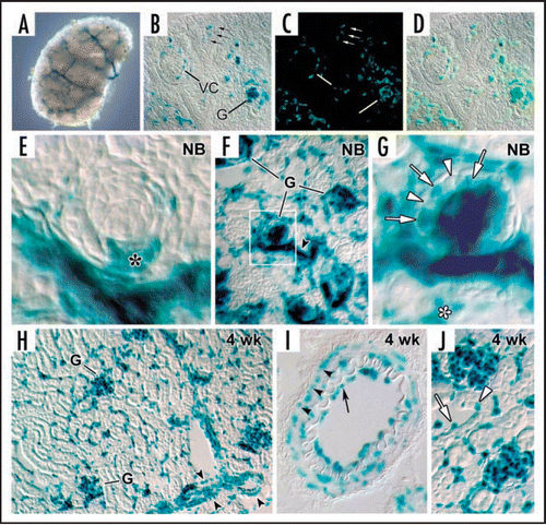 Figure 6 HIF-2α expression in kidney. (A) E13.5 metanephros from a HIF2α+/− stained for β-galactosidase histochemistry shows a branching, vessel-like pattern. (B) E14 HIF2a−/− kidney showing β-galactosidase reaction product in glomerular endothelial cells migrating into the vascular cleft (VC), and in capillary loop stage glomeruli (G). Also, small arrows denote individual cells in the metanephric mesenchyme also containing β-galactosidase. (C) The same slide in B was also labeled with the lectin, BsLB4, an endothelial marker. (D) Co-localization of β-galactosidase and BsLB4 shows complete overlap. (E) Comma-shaped nephric figure from newborn mouse showing HIF2α/LacZ expression by developing podocytes (*). (F) View of newborn mouse showing widespread expression of HIF2α/LacZ in vascular endothelial cells and glomeruli. (G) Boxed region from (F) is shown at higher power. Note HIF2α/LacZ expression in some (arrows) but not all podocytes (arrowheads). (H) Frozen section of a 4 week HIF2α+/− mouse showing intense β-galactosidase product in an endothelial pattern, and in smooth muscle cells of arteries (arrowhead). (I) Frozen section of a 4 week HIF2α+/− mouse showing a small artery. Reaction product is seen in both endothelial cells (arrow) and smooth muscle cells (arrowheads). (J) Vascular endothelial cells (arrow) are positive for HIF2α/LacZ and a few tubular epithelial cells (arrowhead) also express HIF2α/LacZ. Reproduced with permission (ref. Citation76).