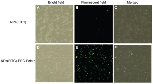 Figure 7 Evaluation of cellular uptake (internalization). Nontargeted nanoparticles-(fluorescein isothiocyanate) (NPs[FITC]) particles (upper panels) and targeted NPs(FITC)-polyethylene glycol(PEG)-Folate particles (lower panels) were incubated with KB cells for 6 hours at 37°C, then washed three times with phosphate buffer solution and observed under an inverted fluorescence microscope (magnification 200×).