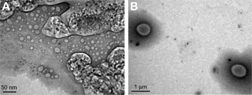 Figure 2 (A and B) Transmission electron micrographs of liposomes. (A) F1, prepared by lipid hydration method (bar = 50 nm) and (B) F2, prepared by heating method (bar = 1 μm).