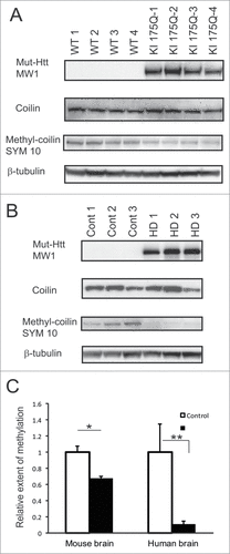 Figure 7. Coilin symmetric dimethylation is reduced in HD mouse and human brain. (A, B) Whole brain homogenates from 4 KI175Q HD and 4 WT mice (A) or homogenates from frozen human frontal superior cortex of 5 normal controls and 5 HD cases (B) were analyzed by Western blotting using the following antibodies: MW1 for detection of expanded Htt; coilin-specific antibody; SYM10 for detection of symmetrically dimethylated coilin and β-tubulin as a loading control. Representative images are shown. (C) Quantification of the relative extent of symmetric dimethylation of coilin presented as a ratio of SYM10 signal intensity to total levels of coilin. (#n = 4, p = 0.007; ##n = 5, p = 0.03).The experiment was repeated 3 times.