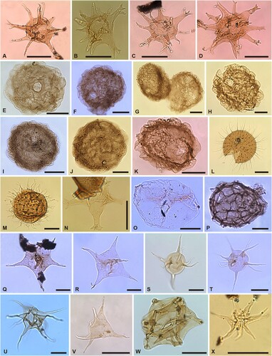 Figure 6. Organic-walled phytoplankton of the Borenshult-1 drillcore. Taxon, sample number, and England Finder Reference (EFR). Scale bars 20 μm. A. Cheleutochroa cf. C. meionia, (34.45 m) EFR: E2/40; B. Cheleutochroa sp. cf. venosior, (38.06 m) EFR: O15/0; C. Cheleutochroa sp. A, (34 m) EFR: L42/3; D. Cheleutochroa sp. A, (40.35 m) EFR: Q21/0; E. Chlamydosphaeridia sp. A, (39.5 m) EFR: J32/3; F. Chlamydosphaeridia sp. A, (40.35 m) EFR: G19/2; G. Chlamydosphaeridia sp. A, (36.4 m) EFR: T15/4; H. Chlamydosphaeridia sp. A, (37.0 m) EFR: G21/1; I. Chlamydosphaeridia sp. A, (34.0 m) EFR: F17/0a; J. Chlamydosphaeridia sp. A, (39.8 m) EFR: M10/3; K. Chlamydosphaeridia sp. A, (40.2 m) EFR: H34/0; L. Comasphaeridium aurora, (37.0 m) EFR: S41/0b; M. Comasphaeridium williereae, (36.7 m) EFR: H34/0a; N. Dateriocradus asturiae, (38.06 m) EFR: E18/4; O. Dicommopalla macadamii, (30.75 m) EFR: H27/4; P. Dictyotidium biscutulatum, (40.2 m) EFR: F46/1; Q. Dorsennidium cf. D. estrellitae, (34.45 m) EFR: E38/2; R. Dorsennidium cf. D. estrellitae, (34.0 m) EFR: N12/0a; S. Dorsennidium inflatum, (33.05 m) EFR: E44/2b; T. Dorsennidium inflatum, (33.05 m) EFR: M42/0b; U. Dorsennidium undosum, (40.1 m) EFR: Q26/2; V. Dorsennidium sp. A, (33.05 m) EFR: G19/3a; W. Enneadikosocheia sp. A, (71.1 m) EFR: T40/1a; X. Estiastra sp. A, (39.1 m) EFR: J26/2.