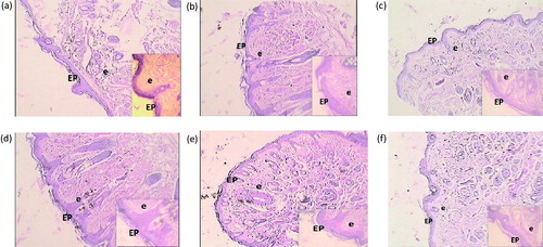 Figure 7. Histological alteration of nasal mucosa in mice: (a) the normal group shows intact epithelium and very few eosinophil infiltrations. (b) The AR control group shows abnormal epithelium, thickened subepithelial smooth muscle layer, and infiltration of eosinophil. (c) The montelukast (10 mg/kg) group shows intact epithelium and reduced eosinophil infiltration. (d) PIP (10 mg/kg) shows less intact epithelium and moderate number of eosinophil infiltrations. (e) PIP (20 mg/kg) shows more intact epithelium and reduced eosinophil infiltration. (f) PIP (40 mg/kg) shows intact epithelium and few eosinophil infiltration. EP, epithelium; e, eosinophiles; PIP, piperine; Monte, montelukast. Figure in parentheses indicates dose in mg/kg, p.o. (40 × ).