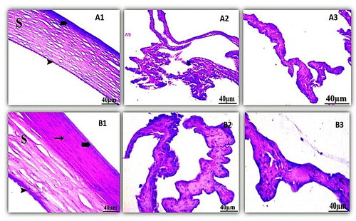 Figure 8. Histopathology microscopy of the cornea (1), ciliary body (2), iris (3) after treatment with the optimized formula of 21 days. Notes: (A) Control; (B) treated, (bold arrow) Showing outer epithelium, (arrowhead) inner endothelium, (S) intermediate stroma, and (arrow) keratocyte.