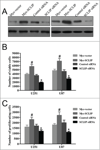 Figure 3. Growth effects of SCLIP on U251 and U87 cells. (A) Expression of SCLIP in U251 and U87 cells transfected with indicated plasmids was determined by protein gel blotting analysis. (B) Cell viability in U251 and U87 cells after SCLIP knockdown and SCLIP overexpression was assessed by MTT assays. Myc-SCLIP vs. Myc-vector, #P<0.05; SCLIPsiRNA vs. Control siRNA, *P<0.05. (C) Cell proliferation was measured using bromodeoxyuridine ELISA assay. At least 3 experiments were run, each in triplicate. Myc-SCLIP vs. Myc-vector, #P<0.05; SCLIPsiRNA vs. Control siRNA, *P < 0.05.