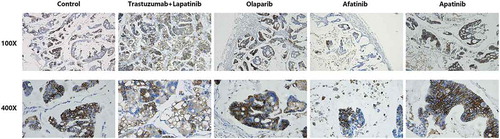 Figure 4. Representative images of immunohistochemistry (IHC) staining of HER2 expression in tumor tissues of PDX models from each group.