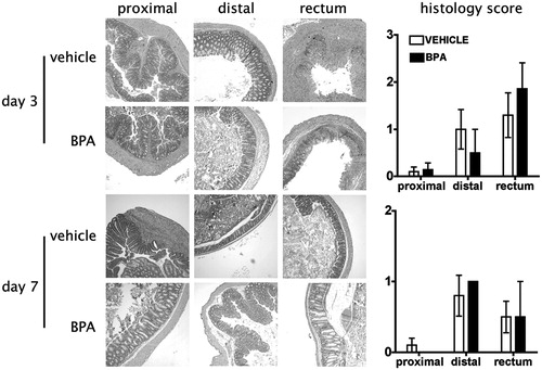 Figure 3.  Developmental exposure to BPA does not alter tissue pathology during inflammatory colitis. Mice were developmentally exposed to BPA during gestation and lactation as described in the Materials and methods section. Colitis was induced to developmentally-exposed adult male mice by rectal administration of DNBS, and sections of colon were collected for histological evaluation on Days 3 (two top rows), 7 (two bottom rows), and 21 (not shown) after DNBS administration (n = 7–8 mice/group/time-point). The photomicrographs of colon sections are from one representative animal from each group at each time-point and the line graphs on the right show the mean ( ± SEM) pathology score for all animals in the group on Days 3 and 7 after DNBS treatment. No detectable pathology was observed in the colon sections collected 21 days after DNBS administration in either group (not shown). Criteria for histopathologic evaluation are described in the Materials and methods. Similar findings were observed in developmentally-exposed female offspring (not shown).