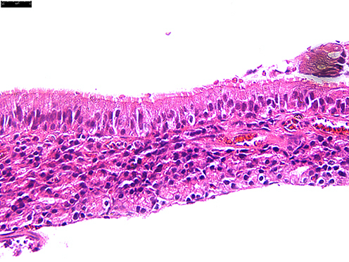 Figure 2 H&E staining results of the experimental group, viewed under a 400X microscope.