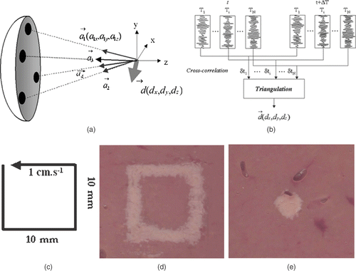 Figure 5. Basic principle of the real-time motion correction. (a) Four subapertures successively send short ultrasonic impulses focusing at the ‘tracking location’. (b) Standard 1D cross-correlations between successive sets of acquisitions permits to recover the 3D displacement vector. (c) Displacement trajectory of a liver sample mounted on three-axis linear motors. Necrosis obtained in the moving liver sample (d) without and (e) with real-time motion correction.