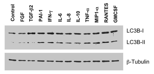 Figure 4 Inflammatory mediators are sufficient to induce autophagy in cultured fibroblasts. Fibroblasts were treated individually with many of the different factors that were upregulated during the MCF7-fibroblast co-culture. Note that treatment with PAI-1, IFNγ, IL-6, IL-8, IL-10, TNFα, MIP1α, RANTES or GMCSF, was sufficient to induce the autophagic response in fibroblasts. Immunoblotting with LC3 was used as a marker of the autophagic response (note the position of LC3-II); β-tubulin is also shown as a control for equal loading. Thus, inflammatory factors can drive the onset of autophagy in fibroblasts.