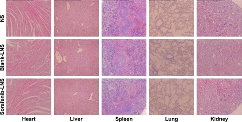 Figure 11 Representative microscopy images of H&E-stained histological sections after treatment with NS, blank-LNS, or sorafenib-LNS.Note: Magnification 40×.Abbreviations: blank-LNS, blank lipid-based nanosuspensions; H&E, hematoxylin and eosin; NS, normal saline; sorafenib-LNS, sorafenib-loaded lipid-based nanosuspensions.