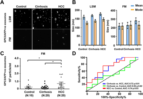 Figure 8 Quantification of AFP and GPC3 double-positive HCC exosome using the combination of two antibodies (AFP and GPC3). (A). Representative video image captured during extracellular vesicles (EVs) analysis in light scattered mode (LSM) and fluorescence mode (FM) of immunocaptured using PE-conjugated AFP and GPC3 antibody combination. (B). Show the size (mean and mode) of immunocaptured EVs using two antibodies measured in LSM and FM. (C) Quantification of immunocaptured EVs using a combination of two antibodies (GPC3/AFP) in normal, cirrhosis and HCC serum detected using FM. The particle number obtained in FM was normalized with the particle number obtained in LSM for each sample. Statistical significance levels were presented as non-significant, * for p<0.05 (D). ROC analysis shows the sensitivity and specificity values of HCC exosome quantification using the combination of AFP and GPC3 antibodies in normal, cirrhosis, and HCC.