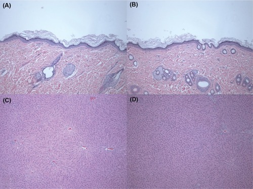 Figure 1 Histopathological findings in the skin and liver after treatment with silica (SiO2) nanoparticles at a dose of 2,000 mg/kg for 90 days.Notes: Skin sections were stained with hematoxylin and eosin (×100): (A) control group, (B) 2,000 mg/kg treatment group. Liver sections were stained with hematoxylin and eosin (×100): (C) Control group, (D) 2,000 mg/kg treatment group. There was no specific change in the skin and liver after treatment with SiO2 nanoparticles at a dose of 2,000 mg/kg for 90 days.