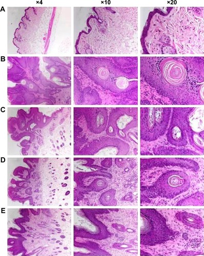 Figure 2 Effect of Leiurus quinquestriatus venom extract on histology of DMBA/croton oil-induced skin tumorigenesis.