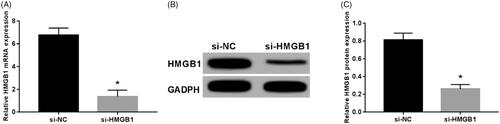 Figure 4. Knockdown of HMGB1 inhibited HMGB1 expression in uterine fibroid cells. (A) Expression of mRNA in uterine fibroid cells after inhibition of HMGB1 expression; (B, C) expression of protein in uterine fibroid cells after inhibition of HMGB1 expression. *p < .05.