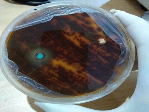 Figure 10 Antifungal activity of CuO nanorods against Trichophyton rubrum.