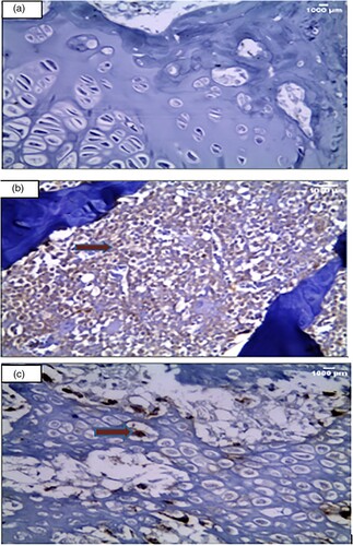 Figure 4. Immuno-histochemical examination (Anti- collagen II x 400). (A): A section in the articular cartilage of knee condyles of the control group showing a negative expression of anti-collagen II in the control group (X400) (B): The knee articular cartilage of the arthritic group showing a strong diffuse anticollagen II expression in inflammatory cells, illustrated by the red arrow in the arthritis group (x400) (C): Section in the irisin-treated arthritic group knee condyles showing a focal moderate expression of anti-collagen II, illustrated by the red arrow (X400).