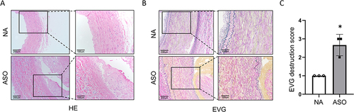 Figure 2 (A and B) The histopathology features of HE and EVG stained normal and ASO arterial tissues sections. (C) Medial elastin destruction was graded as I (mild) to IV (severe).