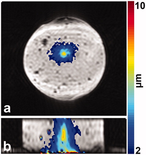 Figure 7. 3 D MR-ARFI displacement maps in coronal (a) and sagittal (b) plane are depicted as a color overlay on the segmented EPI magnitude image.