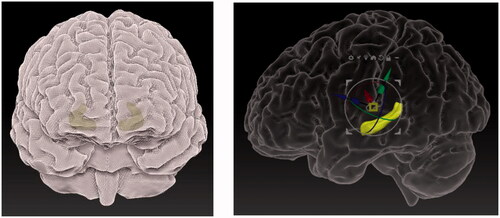 Figure 17. Texturing of the mesh (left) and rendering of the BRP of the model (right).