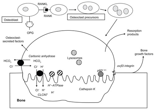 Figure 1 Osteoblasts express a membrane protein, receptor activator of nuclear factor kappa-B ligand (RANKL), which plays a critical role in osteoclast differentiation, activation, and survival.