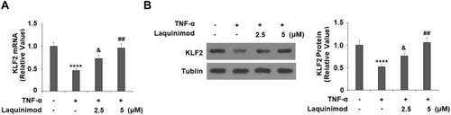 Figure 6 Laquinimod restored TNF-α-induced reduction of KLF2. Cells were stimulated with TNF-α (10 ng/mL) in the presence or absence of laquinimod (2.5, 5 μM) for 24 h. (A). mRNA of KLF2 as measured by real-time PCR; (B). Protein of KLF2 as measured by Western blot analysis (****P<0.0001 vs vehicle group; &P<0.01 vs TNF-α group; ##P<0.001 vs TNF-α group).