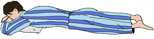 Figure 1 Adaptive training method. The patient was in prone position on the bed with a pillow placed under chest in rest. Dorsiflexed the back and maintain the position with upper limbs for seconds.