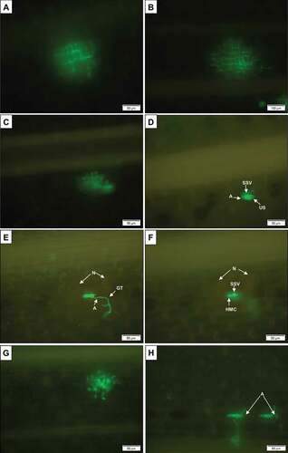 Fig. 5 (Colour online) Microscope images, taken at 120 hpi with Puccinia graminis f. sp. tritici pathotype UVPgt62, showing differences in the size of fluorescing colonies in adult plant leaf sheaths of the stem rust-susceptible entries (a) Line 37–07 and (b) Coorong and resistant entries (c) Kiewiet and (d) Satu, respectively. Images (e) and (f) display the necrotic area associated with a small colony in Kiewiet, (e) on top of the leaf sheath and (f) inside the leaf sheath. Images (g) for the susceptible variety Line 37–07 and (h) for the resistant cultivar Coorong show the comparative leaf sheath penetration process of pathotype UVPgt60. The appressorium (A), germtube (GT), necrotic area (N), substomatal vesicle (SSV) and urediniospore (US) are indicated