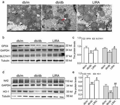 Figure 5. The ferroptosis related signaling pathway in the liver tissue of db/db mice. (a) The ultrastructure of mitochondria observed by TEM (n = 3). The black arrow represents the mitochondrial outer membrane. The red arrow represents regional focal fatty infiltration. (b-c) The expression and statistics of GPX4 and SLC7A11 proteins (n = 6). (d-e) The expression and statistics of Nrf2 and HO-1 proteins (n = 6). The results are presented as the mean ± SEM. *p < 0 05, **p < 0 01 vs. db/m group. #p < 0 05, ##p < 0 01 vs. db/db group.