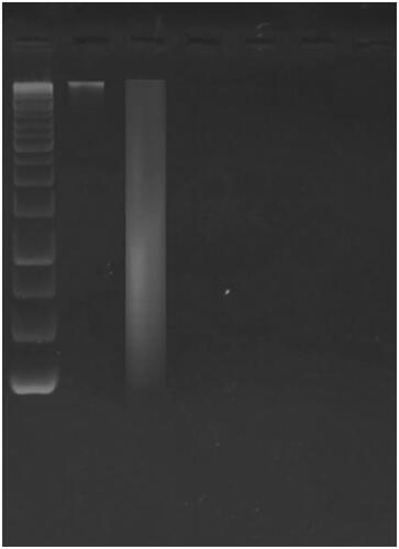 Figure 8. Gel electrophoresis shows fragmentation of the extracted DNA from the treated MDA-MB-231 cells by ferulic acid.