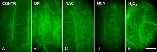 Figure 1. The disturbance of reactive oxygen species (ROS) homeostasis affects tubulin cytoskeleton organization in transgenic Arabidopsis plants expressing GFP:TUA6. (A-E): Epidermal cells from 4-d-old hypocotyls of seedlings treated with distilled water (A) or with ROS modulators (B-E). The decrease of ROS levels forced either by the NADPH oxidase inhibitor diphenylene iodonium (DPI) or by the ROS scavenger n-acetyl-cysteine (NAC) results in disruption and reorganization of the tubulin cytoskeleton into random mesh-like arrays (B, C; cf. A). Similarly, oxidative stress induced by the oxidizing agent menadione (MEN) and hydrogen peroxide (Η2Ο2) results in MT remodeling (D, Ε; cf. A). CONTR, distilled water; DPI, 50 μΜ; ΝΑC, 500 μΜ; ΜΕΝ, 50 μΜ, Η2Ο2, 5 mM. Treatments: 2 h. Scale bar: 10 μm.