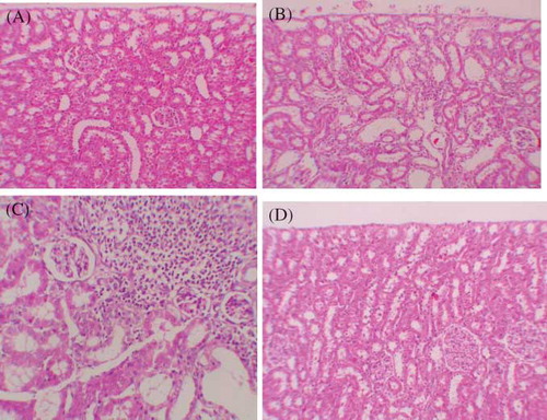 Figure 2.  (A) Normal tubulus and glomerules in kidney cortex H&E 100× (control group). (B) Severe tubular necrosis, tubular degeneration, and epithelial vacuolization in the proximal tubules H&E 100× (GEN-reated group). (C) Moderate tubular necrosis, tubular degeneration, and epithelial vacuolization in the proximal tubules H&E 100× (GEN + vehicle treated group). (D) Mild epithelial vacuolization in the proximal tubules and normal glomerules H&E 100× (GEN + MK treated group).