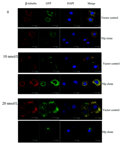 Figure 3. Nlp protected breast cancer cells from cytotoxic apoptosis through suppressing activity of microtubule polymerization elicited by paclitaxel. Two transfected cells were treated by paclitaxel at different concentrations. Cells (attached cells plus those floating in the medium) were harvested and then were immunofluorescence stained by β-tubulin (red) antibody and DAPI (blue) to observe the changes of cytoskeleton after the paclitaxel treatment. The phenomena of microtubules polymerizing into bundles were clearer in the vector control compared with the Nlp transfected clone.