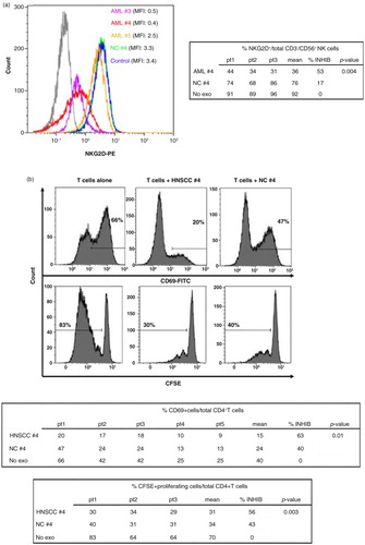 Fig. 6.  Biological activity of exosomes in #4 fractions tested in vitro using normal human lymphocytes. Exosomes were co-incubated with PBMC (a) or with isolated and in vitro activated T cells (b) under conditions described in Materials and Methods. (a) AML exosomes in fractions #3 and #4, but not in fraction #5 down-regulated NKG2D expression levels (MFI) in activated NK cells and reduced the frequency of NKG2D+ in these cells (see table) as determined by flow cytometry with the gate set on CD3-CD56+ NK cells. The MFI data are representative from 1 of 3 experiments performed with exosomes isolated from different AML patients. (b) HNSCC exosomes in fractions #4 down-regulated expression of CD69 (percentages of expression are shown) in activated human CD4+ T cells (upper panels) and suppressed proliferation of T cells activated via the TcR (lower panels). Data shown are representative for different HNSCC patients as shown in the tables. AML=acute myeloid leukaemia; HNSCC=head and neck squamous cell carcinoma; NC=normal control; PBMC=peripheral blood mononuclear cell.