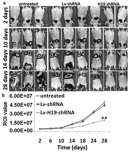 Figure 4. Targeting H19 on tumor metastasis in vivo. (a) The tumor metastasis after tail vein injection of 8505C/H19 shRNA in vivo. (b) The region of interest (ROI) analysis of the whole body based on tumor metastasis.**p < 0.01.