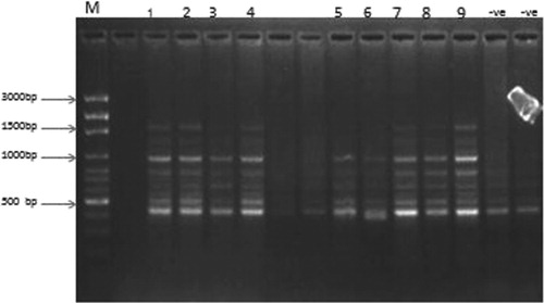 Plate 6. DNA gel electrophoretic band pattern of PCR amplified annexin VII gene using 100 bp molecular marker [M]. Lane 1–2 (PC1-PC2), 3–4 (RB1-RB2), 5–6 (RA1-RA2), 7–9 (RC1-RC3), -ve (NC1-NC2). PC: (positive control): Distilled water + Food only. NC: ARG+ MSG 90:22.5 mg kg−1 b.wt. RA: ARG+ MSG+ extract: 90:22.5:100 mg kg−1 b.wt. RB: ARG+ MSG+ extract: 90:22.5:200 mg kg−1 b.wt. RC: ARG+ MSG+ extract: 90:22.5 + 300 mg kg−1 b.wt.