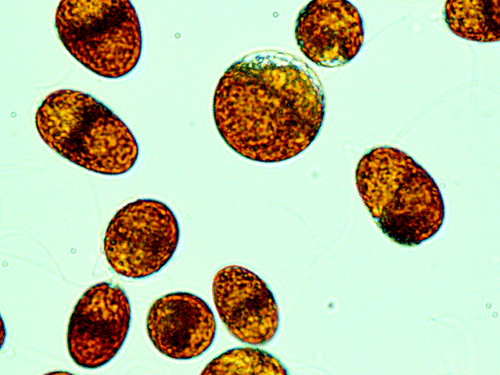 Figure 2. The microalgae Dunaliella urmiana harboring several photosynthetic pigments has adapted to the stressful life in various habitats including Salt Lake Urmia (Isolated and characterized by authors; × 100 magnification under Olympus Invert Microscope).