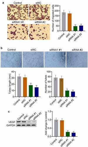 Figure 3. Migration and angiogenesis were inhibited by the knockdown of AKAP4. (a). Transwell assay was used to determine the migration ability of H460 cells. (b). Tube formation assay was used to evaluate the angiogenesis of HUVECs. C. The expression level of VEGF was determined by western blotting assay (**p < 0.01 vs. siNC). The control was H460 cells incubated with blank completed medium.