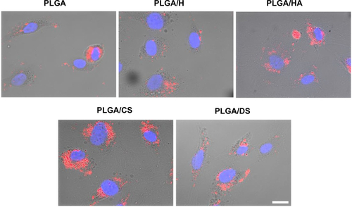 Figure S2 Uptake of glycosaminoglycan-functionalized poly-lactide-co-glycolide (PLGA) nanoparticles by human pulmonary microvascular endothelial cells after 4 hours of incubation as depicted by overlay of differential interference contrast and fluorescence images.Note: Scale bar: 20 μm.Abbreviations: PLGA/CS, poly-lactide-co-glycolide functionalized with chondroitin sulfate; PLGA/DS, poly-lactide-co-glycolide functionalized with dermatan sulfate; PLGA/H, poly-lactide-co-glycolide functionalized with heparin; PLGA/HA, poly-lactide-co-glycolide functionalized with hyaluronic acid.