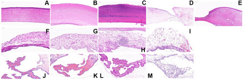 Figure 8 Representative pictures of histopathological section images of cornea (A–E), iris (F–I) and ciliary body (J–M) in healthy rabbits and three groups on day eight. Healthy cornea (A), cornea in CTOIDD-NVCM group (B), eye drop group (C, E), CTOIDD-saline group (D). Healthy iris (F), iris in CTOIDD-NVCM group (G), eye drop group (H), CTOIDD-saline group (I). Healthy ciliary body (J), ciliary body in CTOIDD-NVCM group (K), eye drop group (L), CTOIDD-saline group (M). (A–C) 20× magnification, scale bar 50 μm; (D, E) 10× magnification, scale bar 100 μm; (F–M) 20× magnification, scale bar 50 μm, H&E stain.