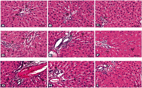 Figure 3. Photomicrographs of liver sections represented the impact of ‘4h’ drug in all inspected groups: (A) Histologic liver section from negative G1 displayed normal portal area (PA); portal vein (PV), hepatic artery (HA), and bile duct (BD) plus hepatic cords (HC). Liver sections from G2 (B) and G3 (C) exposed typical hepatic structures like G1. (D) Histological liver section from S. aureus infected G6 suffered hepatocytes with karyorrhexis (KR), karyolysis (KY), cytoplasmic vacuolation (V), aggregated inflammatory cells (IN), and congested blood vessels (CN). (E) Sections from G7 established partial parts with karyorrhexis (KR), karyolysis (KY) in addition some inflammatory cells (IN). (F) Sections from G8 were noticed with better tissue and a rare nucleus with karyorrhexis (KR) and karyolysis (KY). (G) Histological liver section from S. typhi infected G9 revealed karyorrhexis (KR) and karyolysis (KY) of hepatic cells besides inflammatory cells (IN) and congested blood vessels (CN). (H) Sections from G10 specified some karyolitic cells (KY) along with a few inflammatory cells (IN). (I) Sections from G11 highlighted with few inflammatory cells (IN). (H&E staining, 400x Magnification, Scale bar = 50 μm).