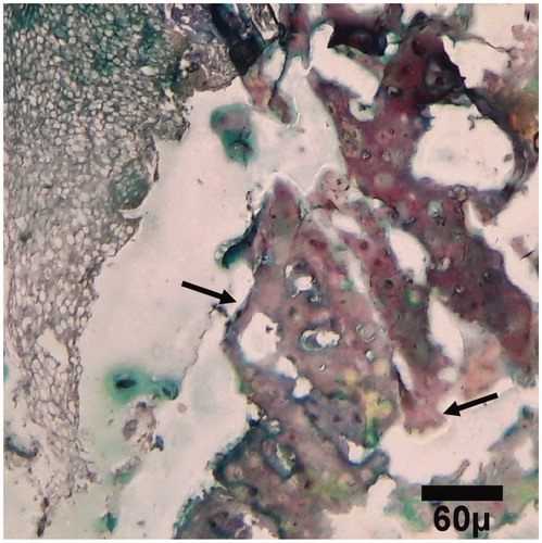 Figure 8. Microscopic section from the healing site of HA-treated group on day 45 of healing. The defect is filled with primary (arrows) bones (trichrom ×100).