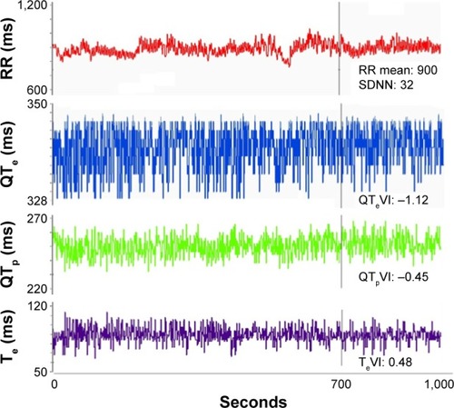 Figure 3 Example of a 5-minute ECG recording: RR, QTe (from the Q wave to the T wave end), QTp (from the Q wave to the T wave peak), and Te (difference between QTe and QTp) intervals and relative variability indexes: SDNN, QTeVI, QTpVI, and TeVI.