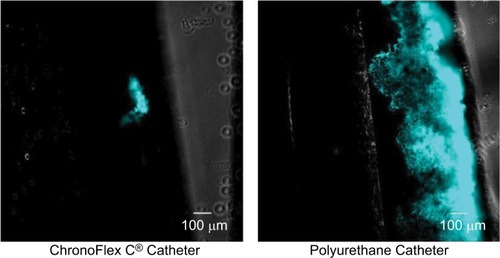 Figure 2 CFP fluorescence.