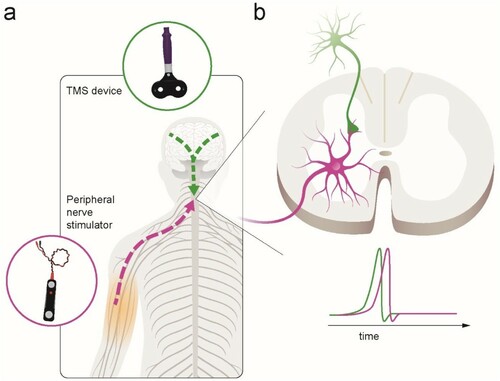 Figure 1 Illustration of paired corticospinal-motoneuronal stimulation (PMCS). (a). Corticospinal neurons are activated via transcranial magnetic stimulation (TMS) over each motor cortex (green lines). Spinal motor neurons are activated antidromically via peripheral nerve stimulation (purple line). (b). The interstimulus interval (ISI) between paired pulses allows descending volleys, elicited by TMS, to arrive at the presynaptic terminal of corticospinal neurons (1st, green spike) 1–2 ms before antidromic volleys, elicited by peripheral nerve stimulation, arrive at the dendrites of the corresponding spinal motor neurons (2nd, purple spike). The precise timing is measured for each muscle targeted using central and peripheral conduction times.